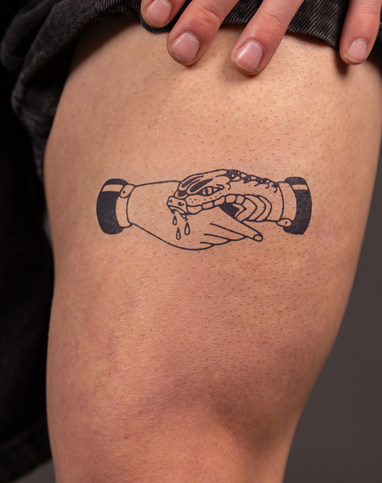 Snake Bite